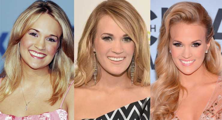 Carrie Underwood Cosmetic Surgery Insights And Impact