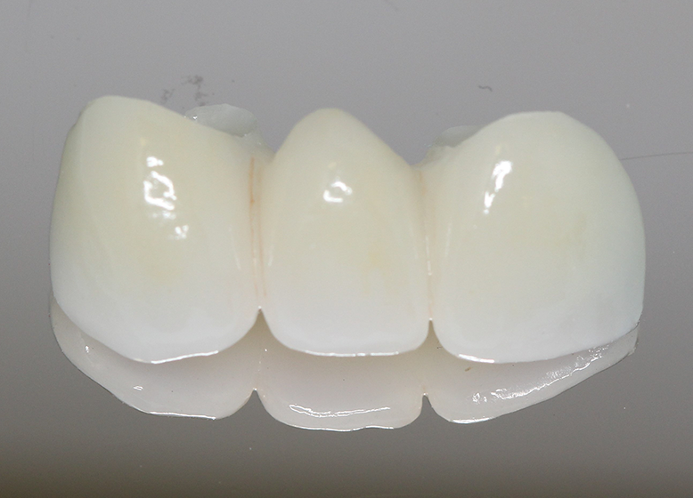 Cosmetic Dentistry | Scottsdale,AZ | Cosmetic Dentistry Scottsdale