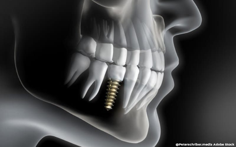 Royalty-Free photo: White dentist chair in white wall painted room ...