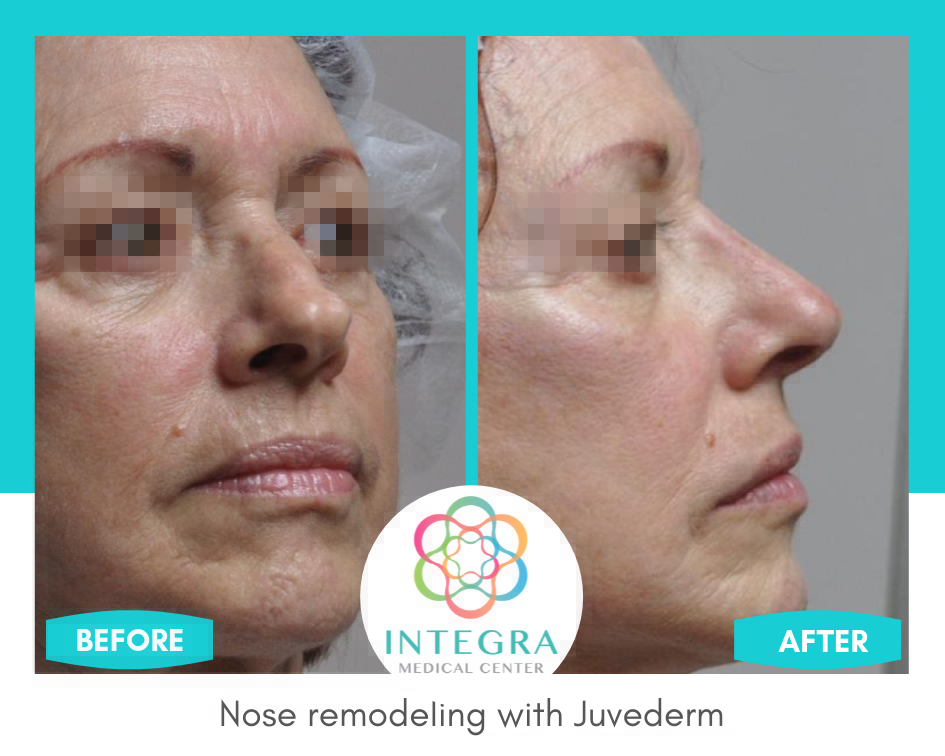 Cosmetic Surgery in Mexico | Integra Medical Center